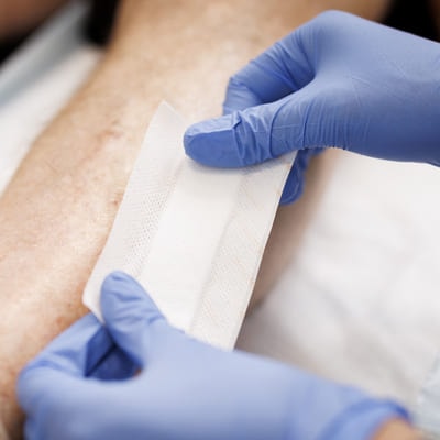 A BlueCare nurse attends to an older man's leg wound dressing